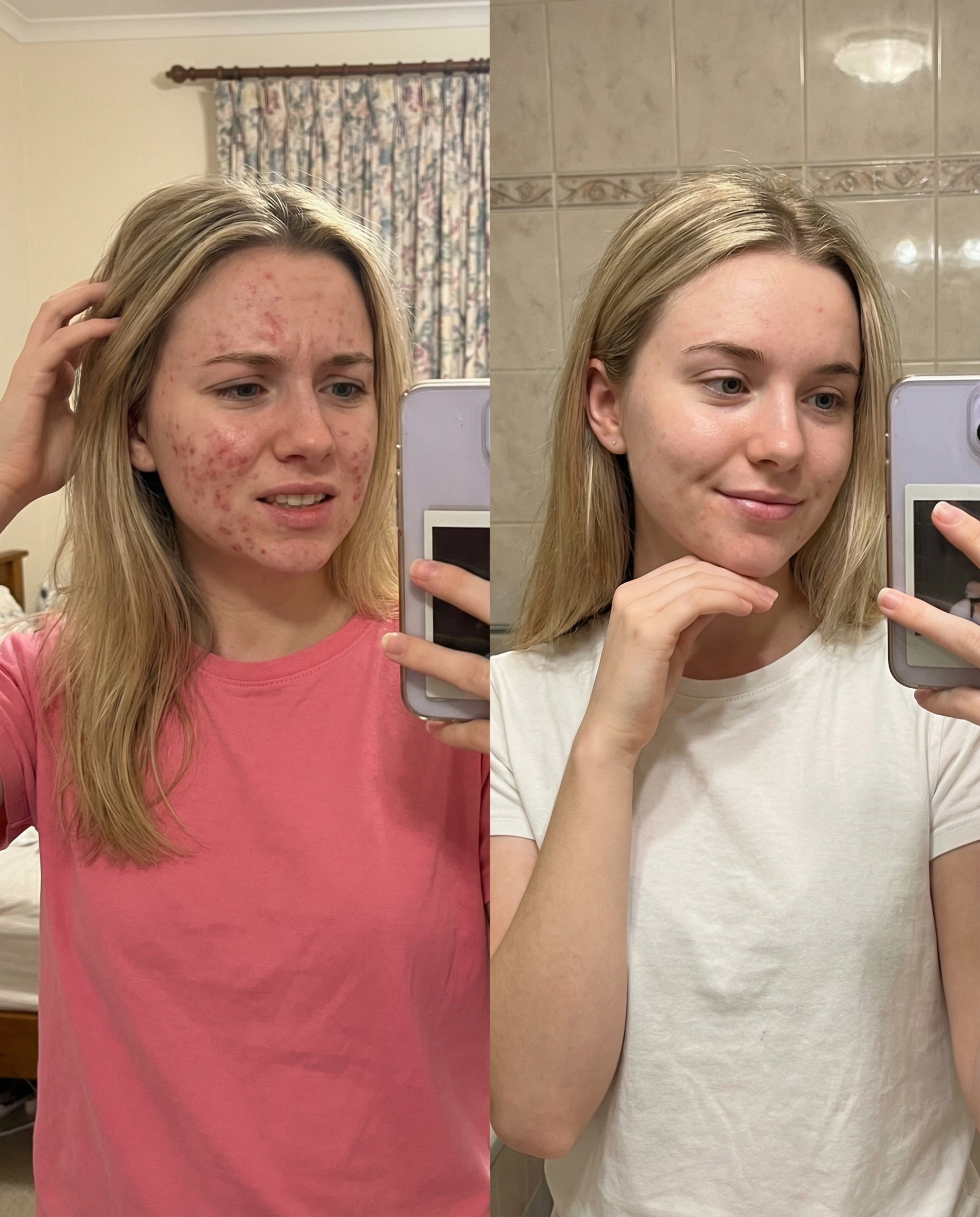 CLERA Microbiome Restore Serum