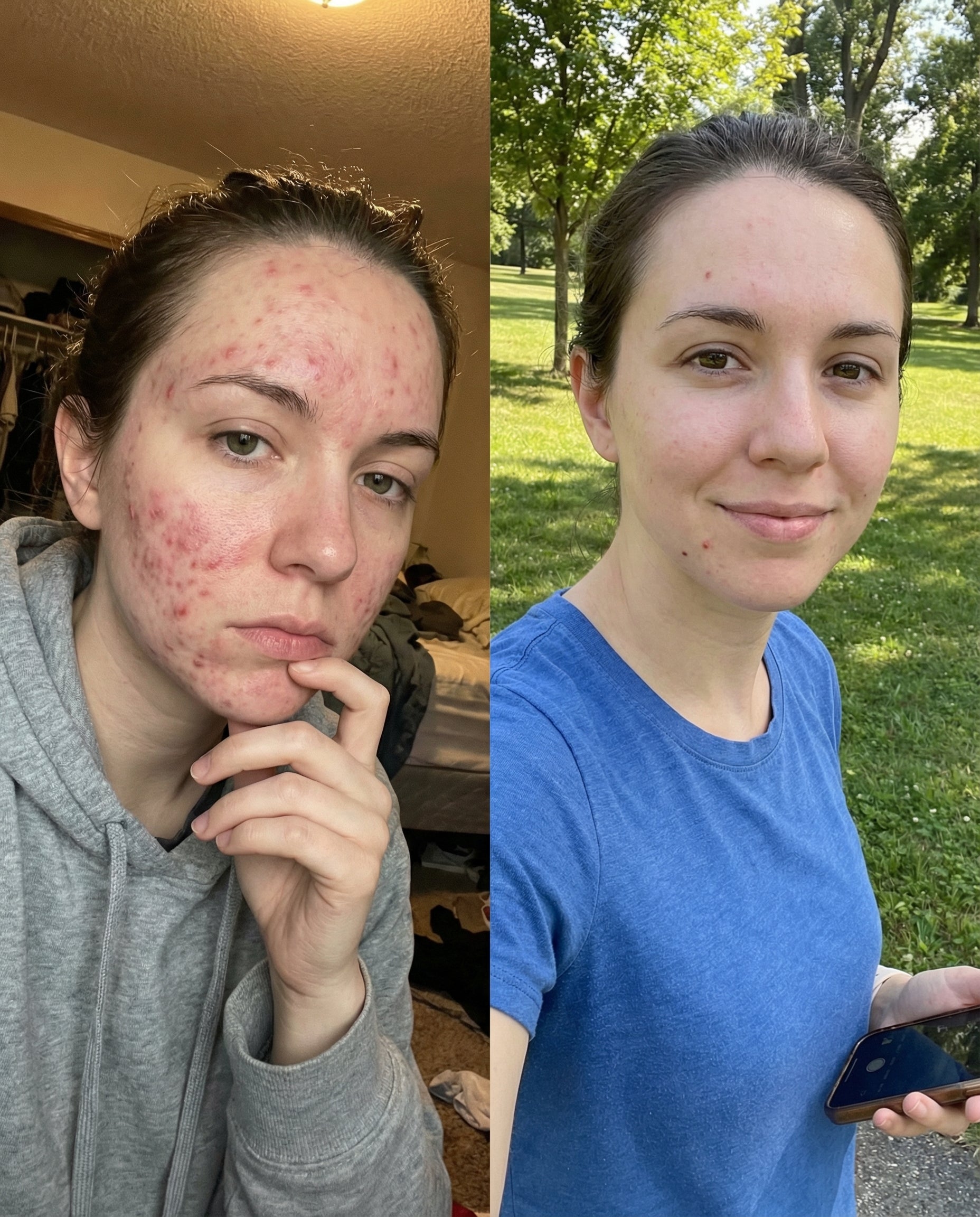 CLERA Microbiome Restore Serum
